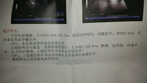 journal_insert_pic_430945127