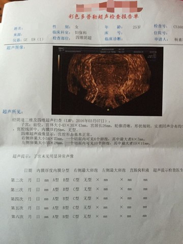 journal_insert_pic_430333723