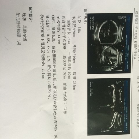 journal_insert_pic_433313933