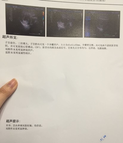 journal_insert_pic_434572813