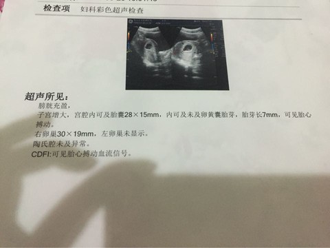 journal_insert_pic_434397560