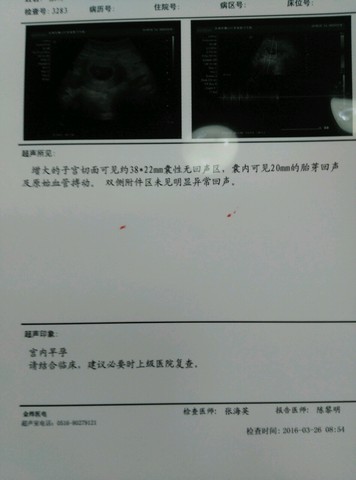 journal_insert_pic_436499521