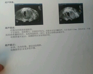 journal_insert_pic_437717946