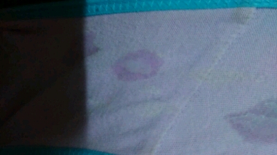 排卵过后这白带正常吗