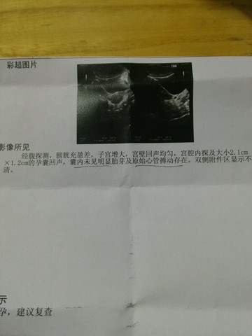 journal_insert_pic_438560376