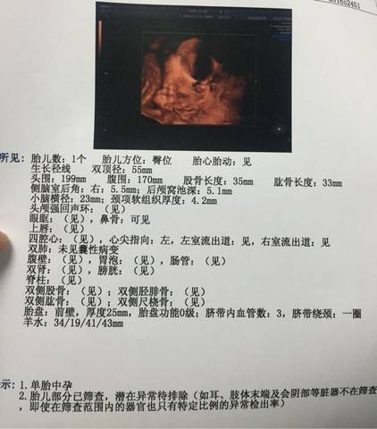 journal_insert_pic_440394413