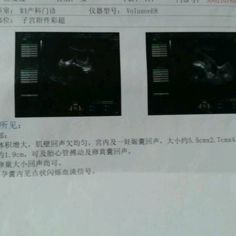 journal_insert_pic_440151022
