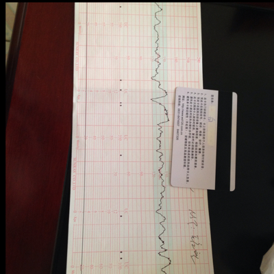 胎心監護圖,又讓明天覆查,醫生也沒說明白具體怎麼了,好擔心啊,都34周