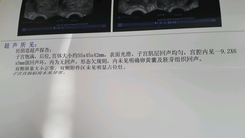 journal_insert_pic_442402827