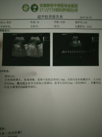 journal_insert_pic_443390742
