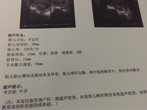 journal_insert_pic_443785180