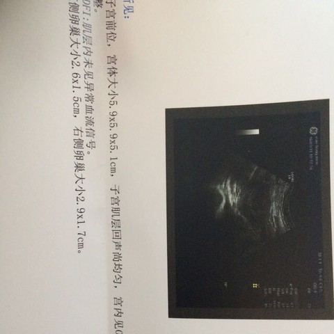 journal_insert_pic_444645011