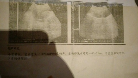 journal_insert_pic_444839370