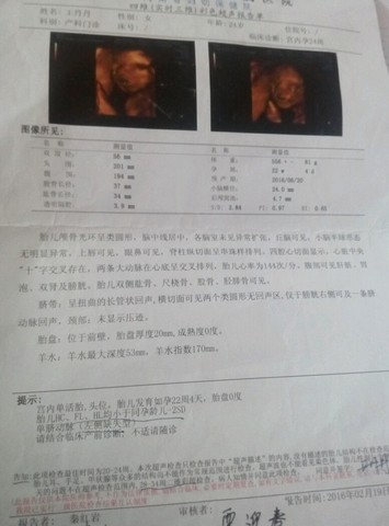 journal_insert_pic_445447983