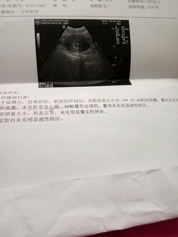 journal_insert_pic_446726272