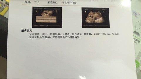 journal_insert_pic_447665117
