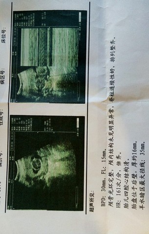 journal_insert_pic_448590381