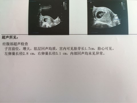 journal_insert_pic_449054533