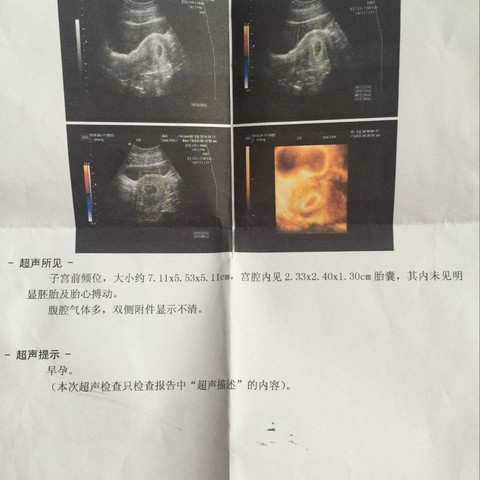 journal_insert_pic_450489680