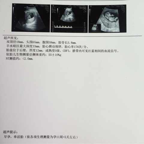journal_insert_pic_450618937