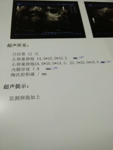 journal_insert_pic_450994297