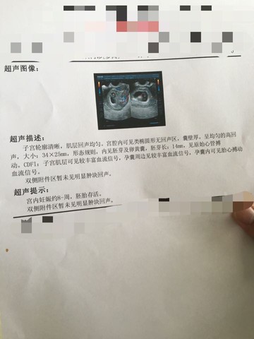 journal_insert_pic_452020406