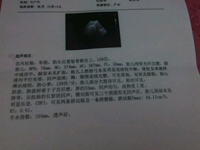 journal_insert_pic_452050313