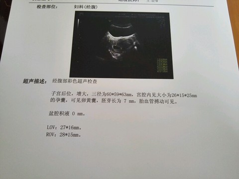 journal_insert_pic_454289192