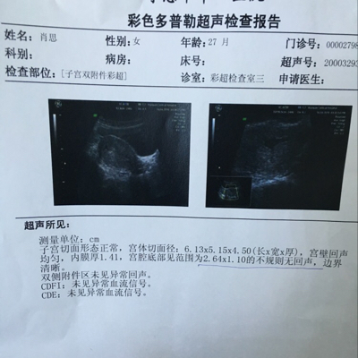 怀孕4周1天 有时会腹痛但没血 去医院血检正常 而b超未见孕囊切宫腔不规则无回声 会不会是宫外孕啊 宝宝树