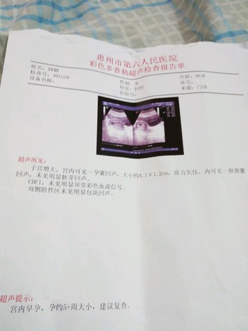 journal_insert_pic_454819153