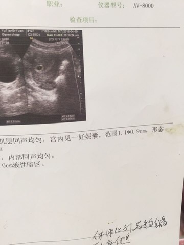 journal_insert_pic_457716764