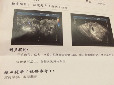 journal_insert_pic_458313576