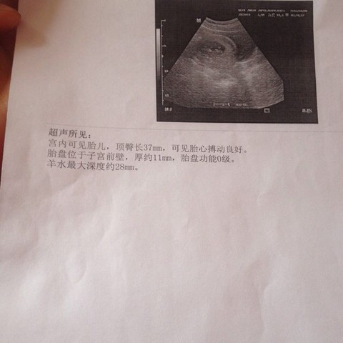 journal_insert_pic_458262434