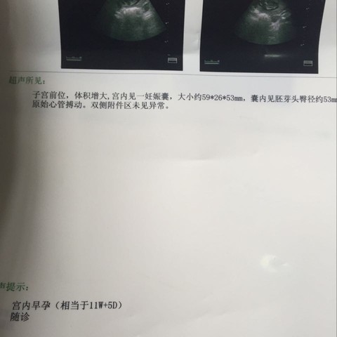 journal_insert_pic_459075916
