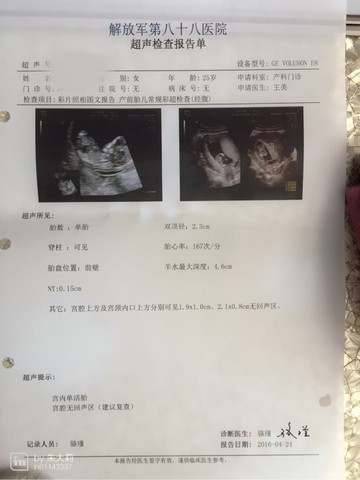 journal_insert_pic_460717025