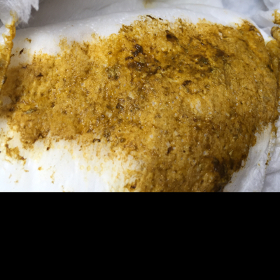 宝宝有点早期肺炎吃药6天了,近三天拉的流水便便,颜色跟药的颜色差不