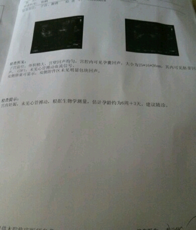 journal_insert_pic_465750277