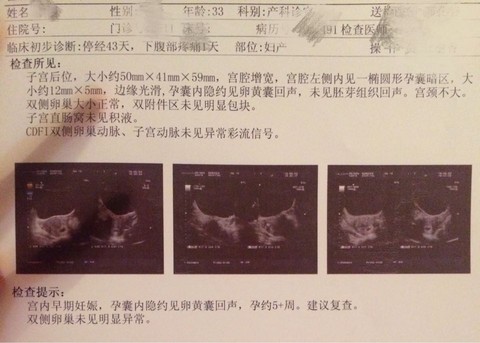 journal_insert_pic_468719203