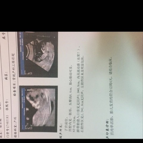 journal_insert_pic_469232716