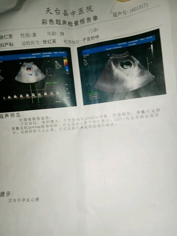 journal_insert_pic_470321113