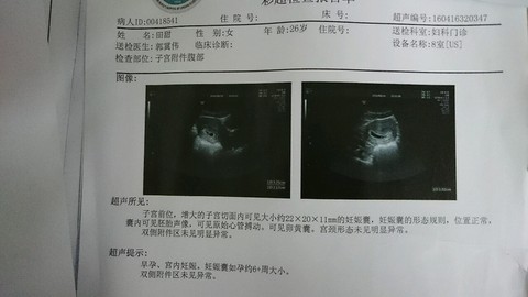journal_insert_pic_470557160