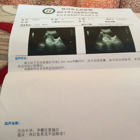 journal_insert_pic_470114197
