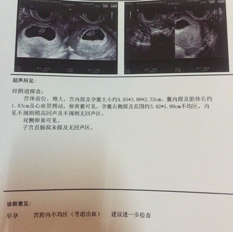 journal_insert_pic_470070656