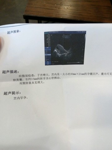 journal_insert_pic_473792829