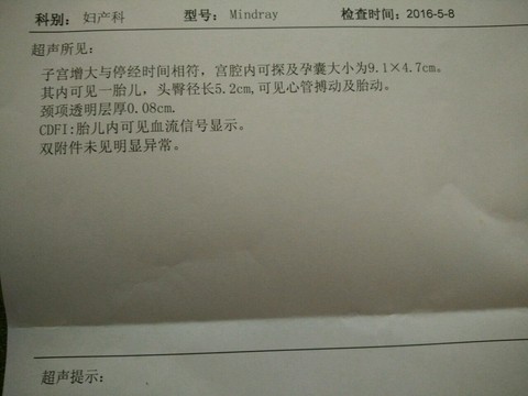 journal_insert_pic_473372721