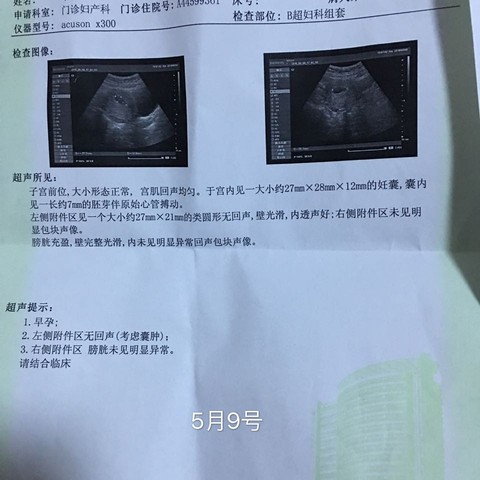 journal_insert_pic_474511753