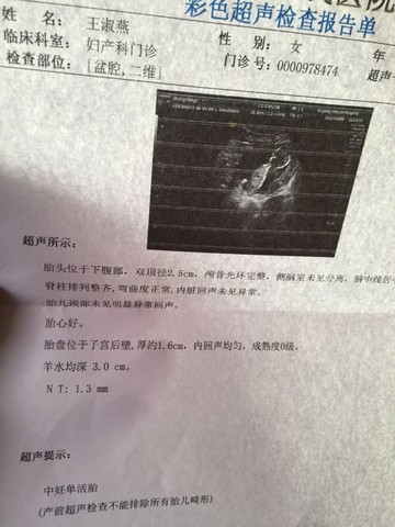 journal_insert_pic_474398041