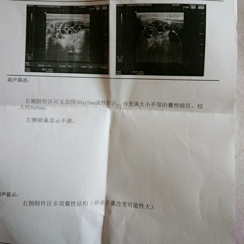 journal_insert_pic_475900779