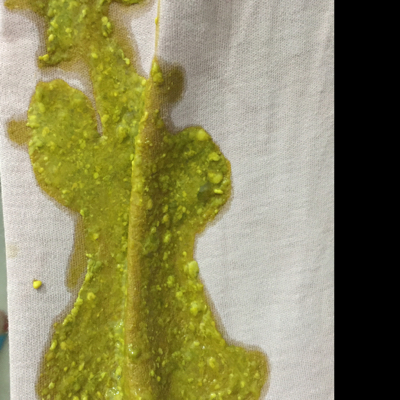 男宝马上4个月了纯母乳餵养,之前一直是两三天拉一次粑粑金黄糊状