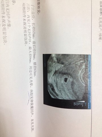 journal_insert_pic_478950230